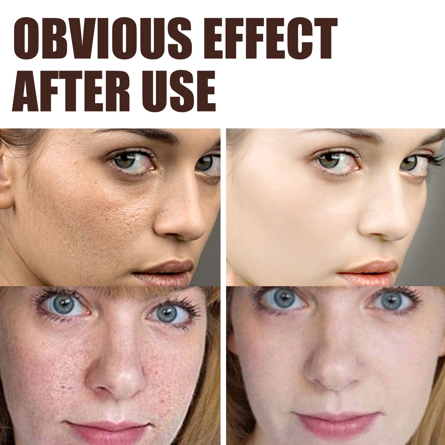 EELHOE Retinol Cream – Firms Skin & Reduces Wrinkles.